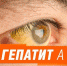 Гепатит А - Камышловский городской округ